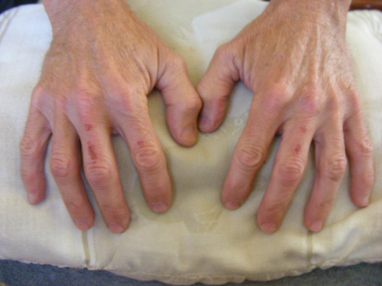 Any motor bike job, no matter, is not complete until some skin is lost or blood has appeared. Then it is, "Well done!"